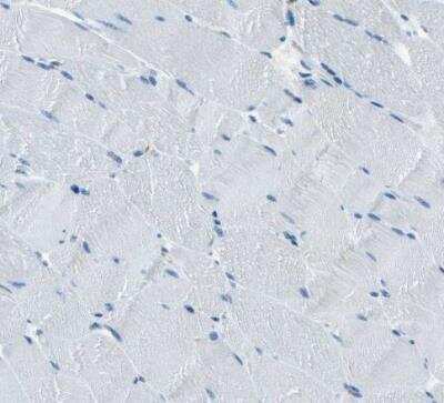 Immunohistochemistry-Paraffin: RRP1 Antibody [NBP1-85338]
