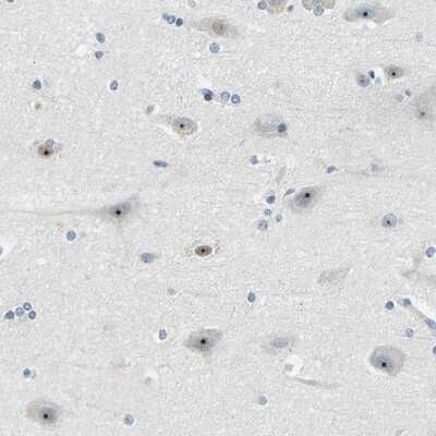 Immunohistochemistry-Paraffin: RRP1 Antibody [NBP1-85339]