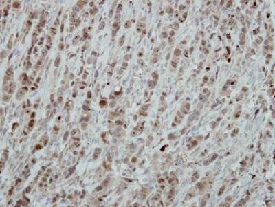 Immunohistochemistry-Paraffin: RRP1 Antibody [NBP2-20233]