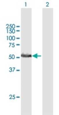 Western Blot: RRP1 Antibody [H00008568-B01P]