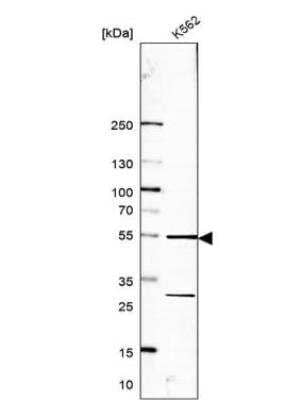 Western Blot: RRP1 Antibody [NBP1-85338]