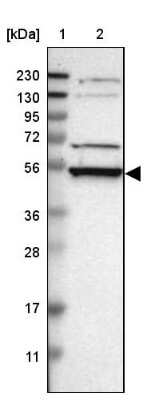 Western Blot: RRP1 Antibody [NBP1-85339]