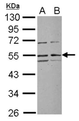 Western Blot: RRP1 Antibody [NBP2-20234]