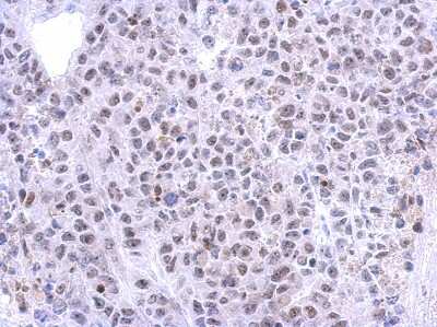 Immunohistochemistry-Paraffin: RRP12 Antibody [NBP2-15105]