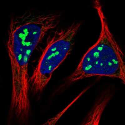 Immunocytochemistry/ Immunofluorescence: RRP15 Antibody [NBP1-84522]