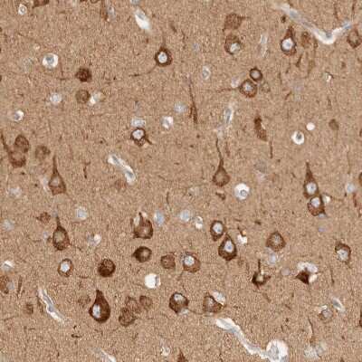 Immunohistochemistry-Paraffin: RRP15 Antibody [NBP1-84522]