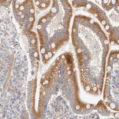 Immunohistochemistry-Paraffin: RRP15 Antibody [NBP1-84522]