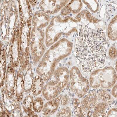Immunohistochemistry-Paraffin: RRP15 Antibody [NBP1-84522]