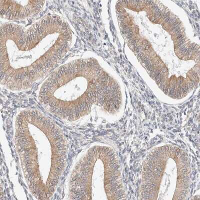 Immunohistochemistry-Paraffin: RRP15 Antibody [NBP1-84522]