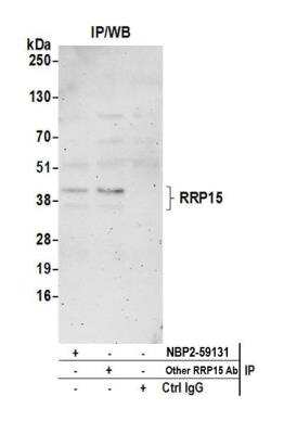 Immunoprecipitation: RRP15 Antibody [NBP2-59131]