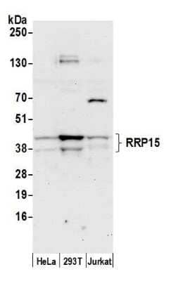 Western Blot: RRP15 Antibody [NBP2-59131]