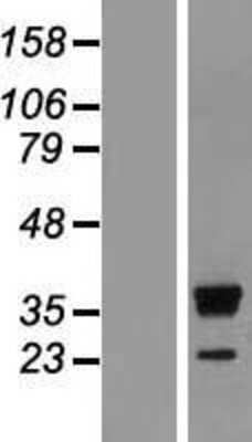 Western Blot: RRP15 Overexpression Lysate [NBL1-15591]