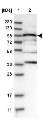 Western Blot: RRP1B Antibody [NBP1-81534]