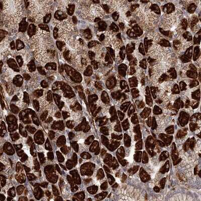 Immunohistochemistry-Paraffin: RRP36 Antibody [NBP1-86758]