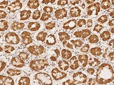 Immunohistochemistry-Paraffin: RRP36 Antibody [NBP2-98183]