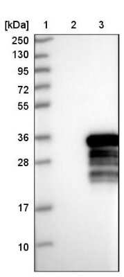 Western Blot: RRP36 Antibody [NBP1-86758]