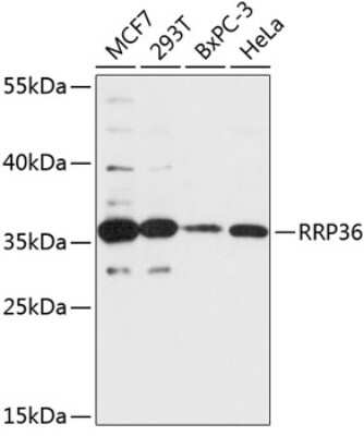 Western Blot: RRP36 AntibodyAzide and BSA Free [NBP2-93274]