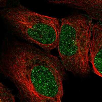 Immunocytochemistry/ Immunofluorescence: RRP4 Antibody [NBP2-58481]