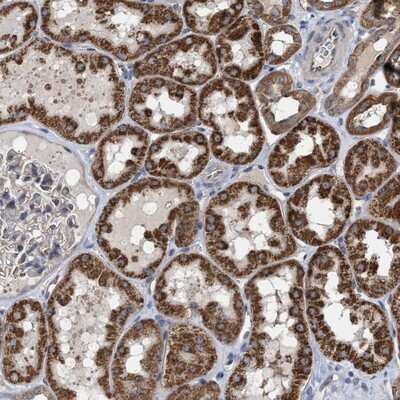 Immunohistochemistry-Paraffin: RRP4 Antibody [NBP1-92355]