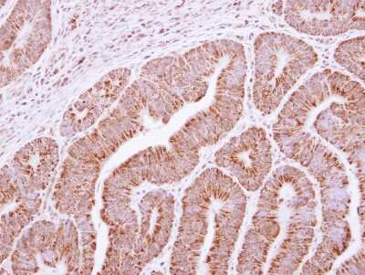 Immunohistochemistry-Paraffin: RRP4 Antibody [NBP2-20235]