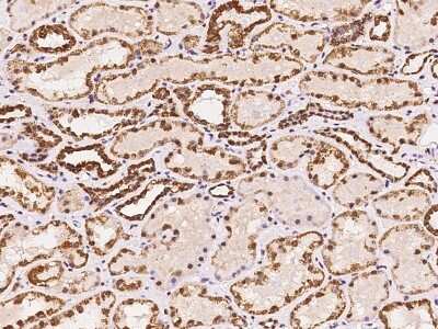 Immunohistochemistry-Paraffin: RRP4 Antibody [NBP2-97759]