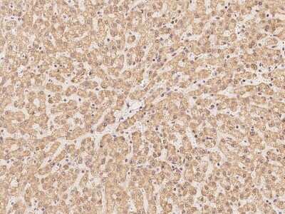 Immunohistochemistry-Paraffin: RRP4 Antibody [NBP2-97759]