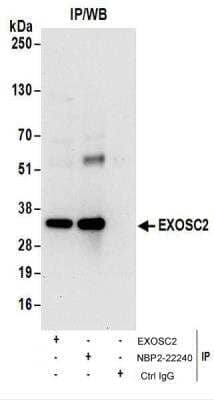 Immunoprecipitation: RRP4 Antibody [NBP2-22240]