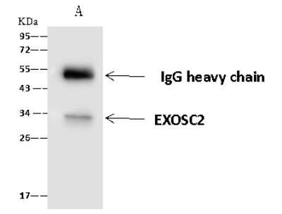 Immunoprecipitation: RRP4 Antibody [NBP2-97759]