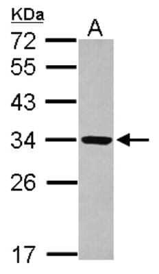 Western Blot: RRP4 Antibody [NBP2-20235]