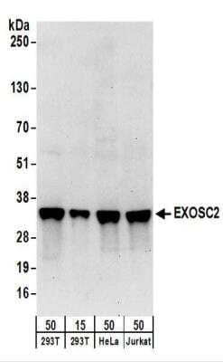 Western Blot: RRP4 Antibody [NBP2-22240]