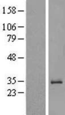 Western Blot: RRP4 Overexpression Lysate [NBL1-10384]