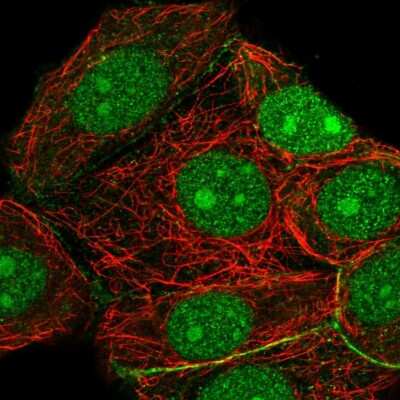 Immunocytochemistry/ Immunofluorescence: RRP7A Antibody [NBP2-56719]