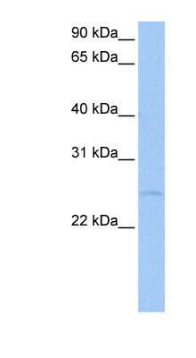 Western Blot: RRP7A Antibody [NBP1-57551]