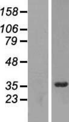 Western Blot: RRP7A Overexpression Lysate [NBL1-09135]