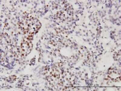 Immunohistochemistry-Paraffin: RRP9 Antibody (1E8) [H00009136-M01]