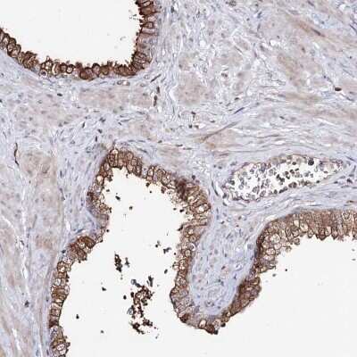 Immunohistochemistry-Paraffin: RRP9 Antibody [NBP1-87118]