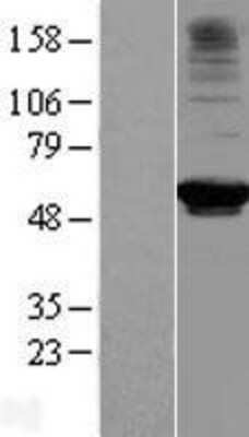 Western Blot: RRP9 Overexpression Lysate [NBL1-15593]