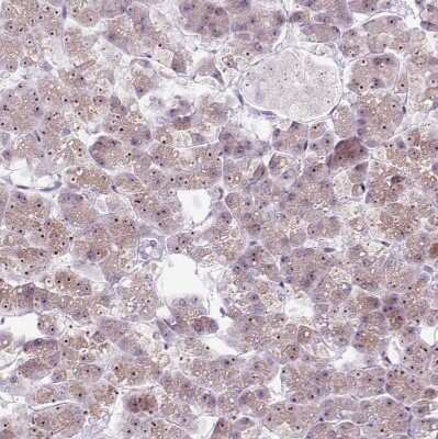 Immunohistochemistry-Paraffin: RRS1 Antibody [NBP2-30725]