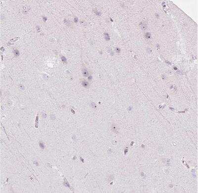 Immunohistochemistry-Paraffin: RRS1 Antibody [NBP2-30725]