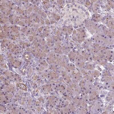 Immunohistochemistry-Paraffin: RRS1 Antibody [NBP2-49323]