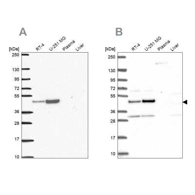 Western Blot: RRS1 Antibody [NBP2-30725]