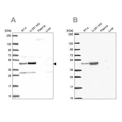 Western Blot: RRS1 Antibody [NBP2-49323]