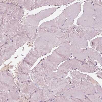 Immunohistochemistry-Paraffin: RS1 Antibody [NBP2-56487]