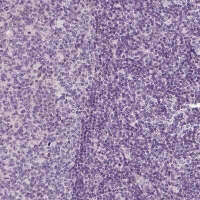 Immunohistochemistry-Paraffin: RS1 Antibody [NBP2-56487]