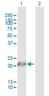 Western Blot: RS1 Antibody [H00006247-B01P]