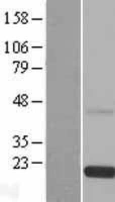 Western Blot: RS1 Overexpression Lysate [NBL1-15595]