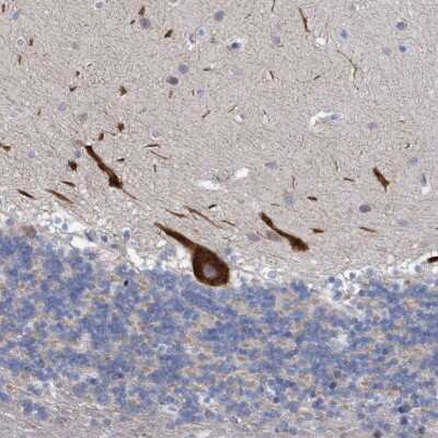 Immunohistochemistry-Paraffin: RSAD1 Antibody [NBP1-83771]