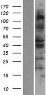 Western Blot: RSAD1 Overexpression Lysate [NBP2-06814]