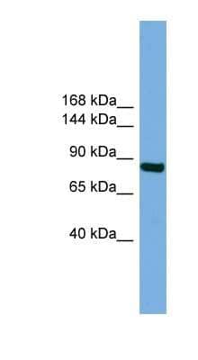 Western Blot: RSBN1 Antibody [NBP1-57724]