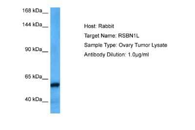 Western Blot: RSBN1L Antibody [NBP2-85678]